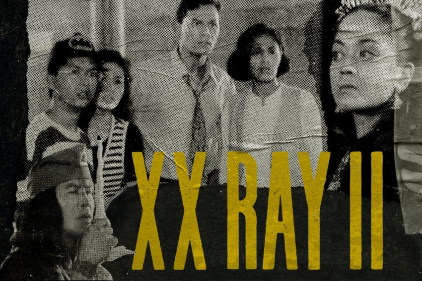 XX RAY II